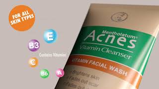 ACNES VITAMIN CLEANSER KENYA [upl. by Rickart]