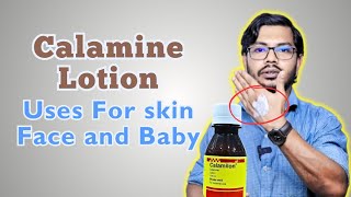 Calamine Lotion  ক্যালামাইন লোশন ব্যবহারের নিয়ম [upl. by Sami945]