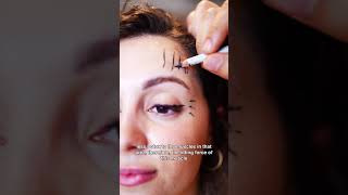 Botox Brow Lift What Is It amp How Does It Work  Dr Elad Azizli [upl. by Aihtyc]