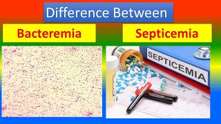 Difference between Bacteremia and Septicemia [upl. by Lark]