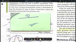 Cardiac Action Potential 3 [upl. by Assirhc]