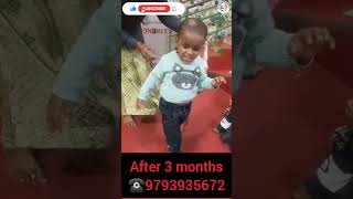 cerebralpalsytreatment physiotherapy childphysiotherapy gorakhpur physiodrshivomsingh cpchild [upl. by Absa26]