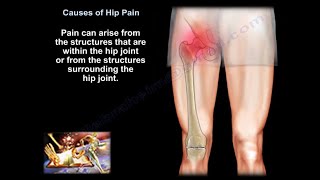 hip pain causes diagnosis and treatment [upl. by Tterrab493]