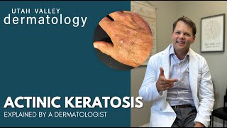 Actinic Keratosis Explained by a Dermatologist  Utah Valley Dermatology [upl. by Samford]