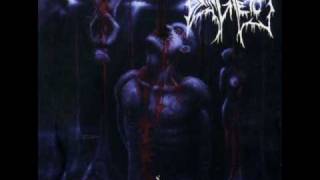 Dying Fetus  Streaks Of Blood [upl. by Lauder15]