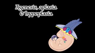 Agenesis Aplasia and Hypoplasia [upl. by Gerianna257]