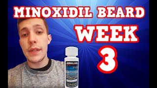 Monoxidil Beard  Week 3  Minoxidil 5 for Beard Growth  Facialfuzzfridays [upl. by Vaclava934]