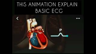 ECG Made Simple Understanding Heart Rhythms [upl. by Morrissey]