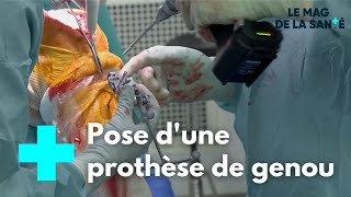 Prothèse de genou  une chirurgie de haute technologie  Le Magazine de la Santé [upl. by Marlon872]