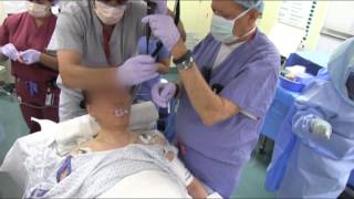 Severe Arthritic Syndrome Awake Intubation from AOD [upl. by Khorma]