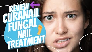 Curanail Fungal Nail Treatment  Review [upl. by Yehc]