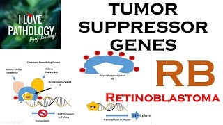 NEOPLASIA 3 TUMOR SUPPRESSOR GENES Retinoblastoma Gene Knudsons Two Hit Hypothesis [upl. by Joyann630]