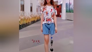 The beautiful amputee woman challenges disability with an artificial leg amputee model facts [upl. by Kletter]