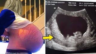 Pregnant Womans Visit Hospital Because Belly Kept Growing  Doctor Turns Pale When He Sees [upl. by Pathe]