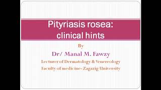 Pityriasis rosea clinical hints [upl. by Pooi]