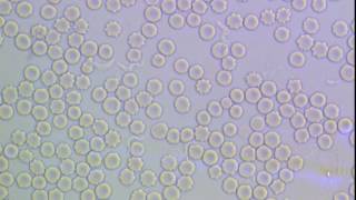 Trypanosoma brucei in mammalian blood [upl. by Ecilegna]