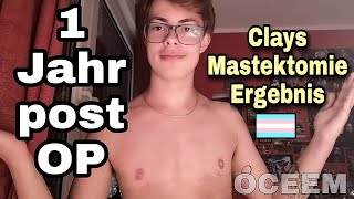 Ein Jahr post Mastektomie  Operation  ftm  Mastek  Clay  Oceem [upl. by Najar529]