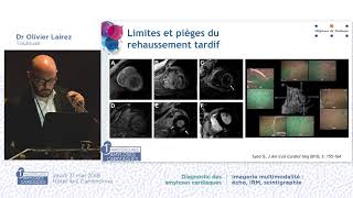 LIRMcardiaquepourlediagnosticdesamylosescardiaquesOlivierLairezMACMRIandAmyloidosis [upl. by Ilyah]