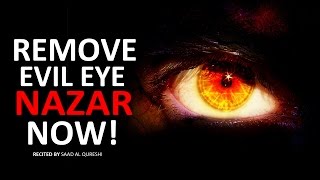 REMOVE EVIL EYE NOW  Very Powerful  MUST WATCH [upl. by Seeto]