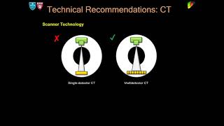 25 LIRADS Technical Recommendation  Part 1 By Dr Avinash Kambadakone [upl. by Aicilif]