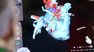 Mayo Clinic Minute What is cardiogenic shock [upl. by Kennard]