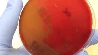 Microbiology  Hemolysis [upl. by Im]