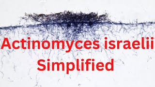 Actinomyces israelii Simplified TRICK [upl. by Ballman]