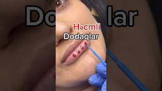 microblading keşfetteyiz bakuazerbaijan baku lips [upl. by Vitoria]