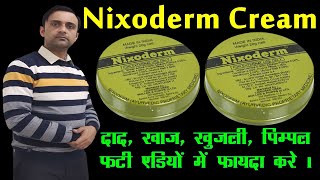 nixoderm for skin problems nixoderm ke fayde निक्सोडर्म [upl. by Hindu]