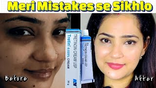 Watch This Before Starting Tretinoin—My Biggest Mistakes Revealed  Indian Youtuber Anmol [upl. by Fawna129]