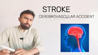 Cerebrovascular accident Stroke dispenser class PMF [upl. by Andra]