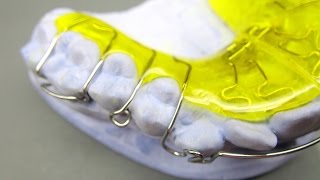 Herstellung einer Dehnplatte KFO Kieferorthopädie Orthodontics active plate Labial Bow Adams clasp [upl. by Ennirac18]