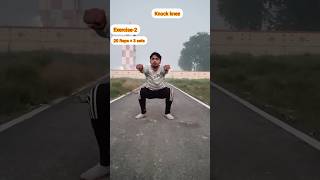 केवल 1 महीनें में Knock Knee से छुटकारा ये चार Exercises प्रतिदिन करियेगा  knock shorts [upl. by Gamal]