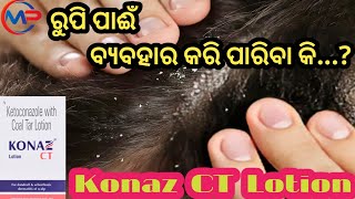 ରୁପି ପାଈଁ ବ୍ଯବହାର କରିବା Konaz CT Lotion Uses for Dandruff Psoriasis Skin infection Allergies Re [upl. by Celestine]