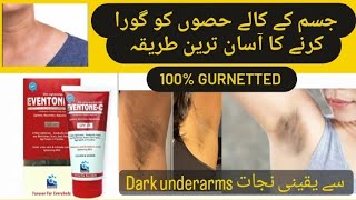 Whitening of Dark underarms  Eventone C cream uses [upl. by Rikahs450]