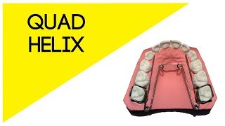 ❇️Elaboración de quotQUAD HELIXquot Aparato de Expansión Superior Fijo Odontología🦷 2020 [upl. by Tierney429]