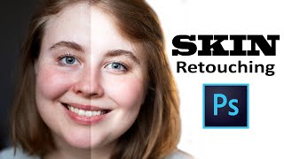 Professional Skin Retouching  Adobe Photoshop [upl. by Lari]