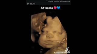 32 weeks 4D baby scan ultrasoundpics pregnancyscan pregnant ultrasound babyscan weekspregnant [upl. by Blainey]