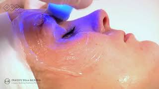 Exilis Ultra 360º  Aparatologia Facial [upl. by Eneleahcim]