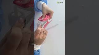 Dental Base Plate Wax [upl. by Ajax]