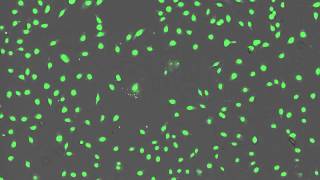 Time Lapse Imaging of BPAEC Cells Treated With Menadione [upl. by Winfield]