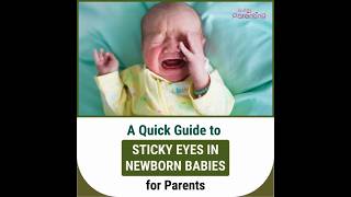 Sticky Eyes In Newborn Babies  Causes Risks And Remedies [upl. by Blinnie]