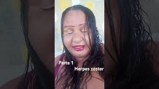 herpes zoster [upl. by Aissert]