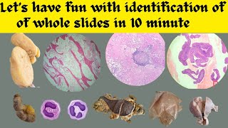 Let’s have fun with identification of whole slides in 10 minutes😊 Pathology practical exam OSPE [upl. by Jevon]