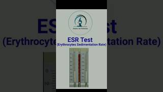 ESR Test Erythrocytes Sedimentation Rate  Hematology Test  Normal value pathologylab [upl. by Xonk6]