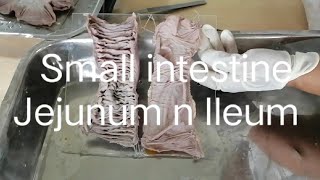 Anatomy of Small intestine jejunum ileum [upl. by Egroeg]