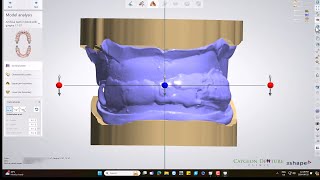 CUDCLD Design with 3D Biteplate [upl. by Jariv151]