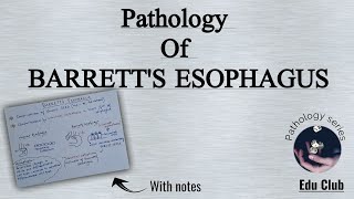 Barretts Esophagus  GIT Pathology [upl. by Lombard]