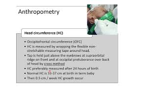 Anthropometry Measurements in Newborn  Pediatrics [upl. by Ebony]