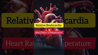 Relative Bradycardiatyphoidfever medicine bradycardia neetpg fmge [upl. by Ettecul164]